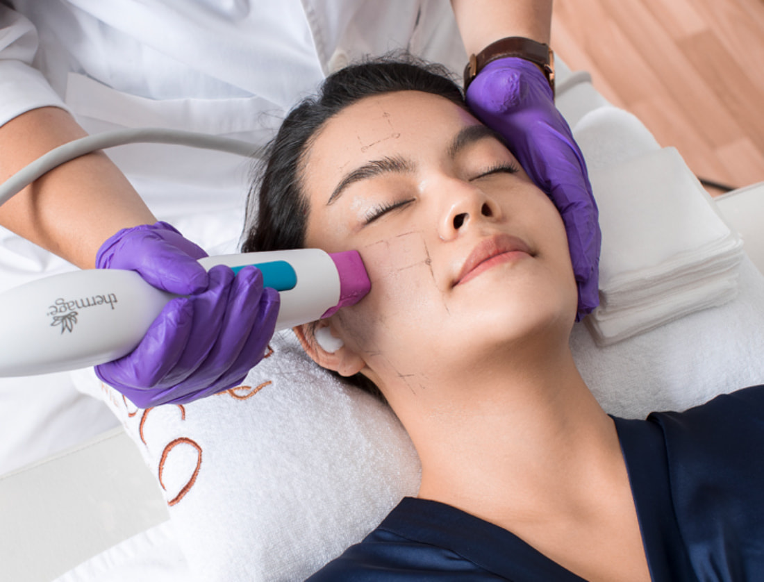 Thermage là công nghệ có khả năng xoá nếp nhăn hiệu quả