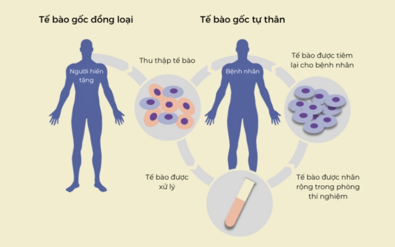 Quy trình điều trị bằng tế bào gốc