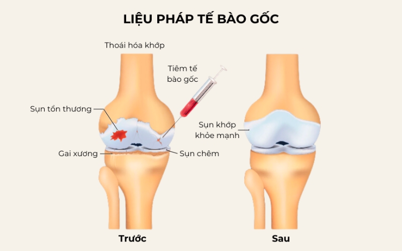 Liệu pháp tế bào gốc đem lại nhiều ưu điểm vượt trội