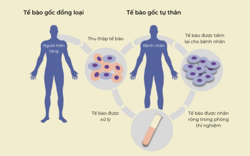 Quy trình điều trị bằng tế bào gốc