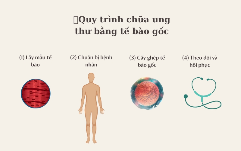 Quy trình cấy ghép tế bào gốc chữa bệnh ung thư gồm 4 giai đoạn