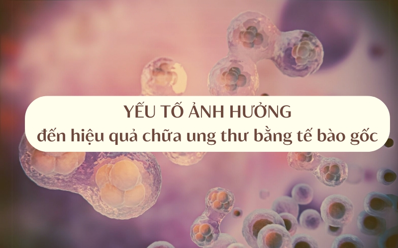 Cấy ghép tế bào gốc điều trị ung thư có tỷ lệ thành công cao hay không sẽ phụ thuộc vào nhiều yếu tố